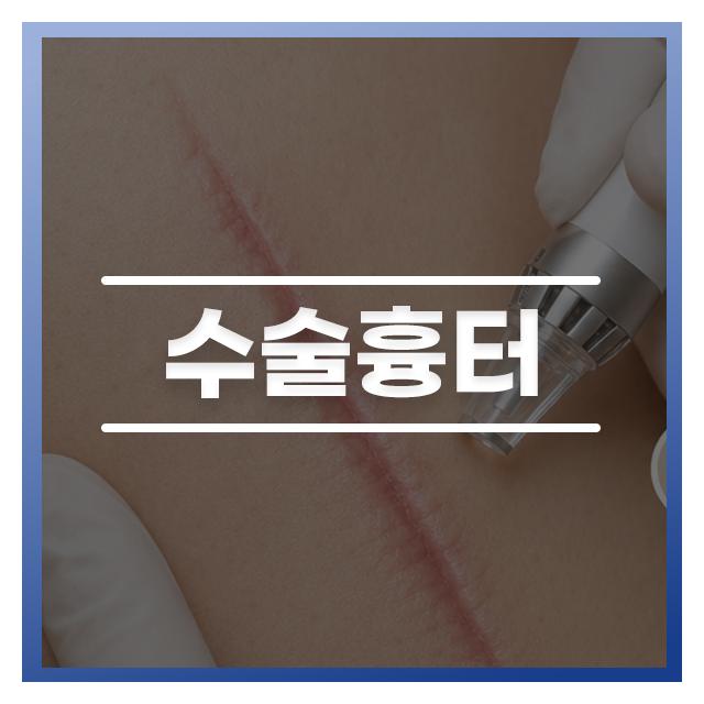 눈에 띄는 흉터로 남은 수술흉터 치료는 더공감성형외과의원에서